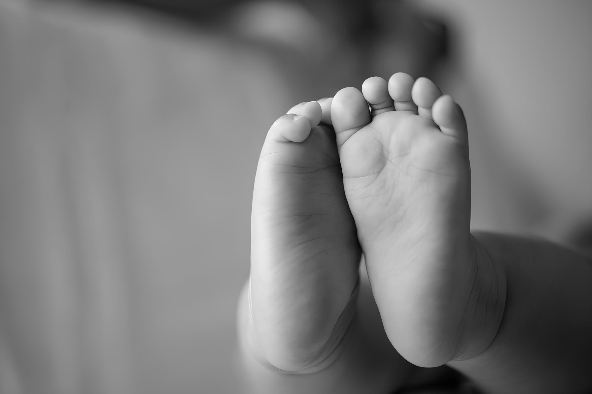 A Vida Além do Diagnóstico: O Que é a Síndrome de Edwards e Como Ela Desafia as Expectativas Médicas? 1