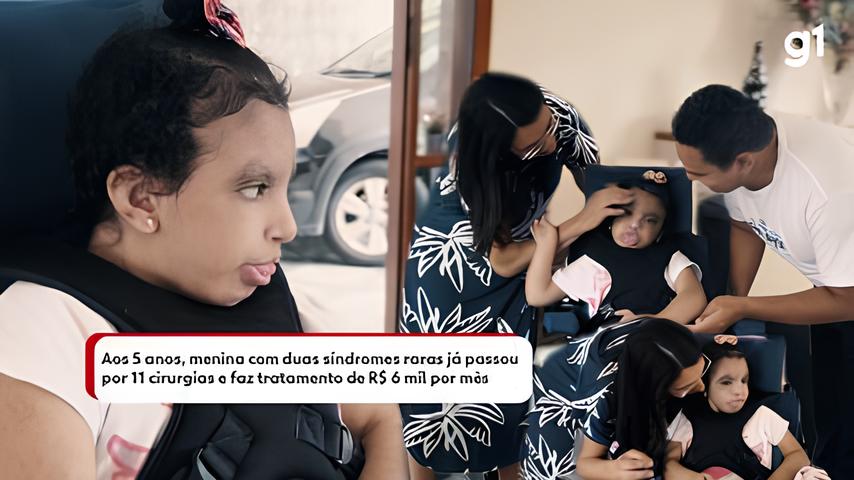Uma Vida de Supera o A Jornada de Valentina a Menina que Desafiou as Estat sticas da S ndrome de Edwards