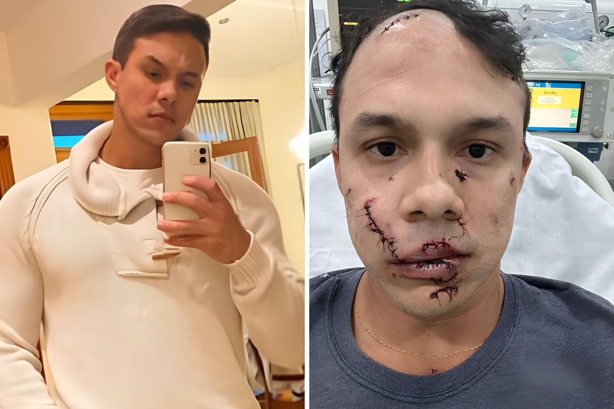 A Vergonha de Um Copo de Vidro: O Caso do Personal Trainer Que Virou Vítima Para Defender Outros 1 A Vergonha de Um Copo de Vidro O Caso do Personal Trainer Que Virou V tima Para Defender Outros
