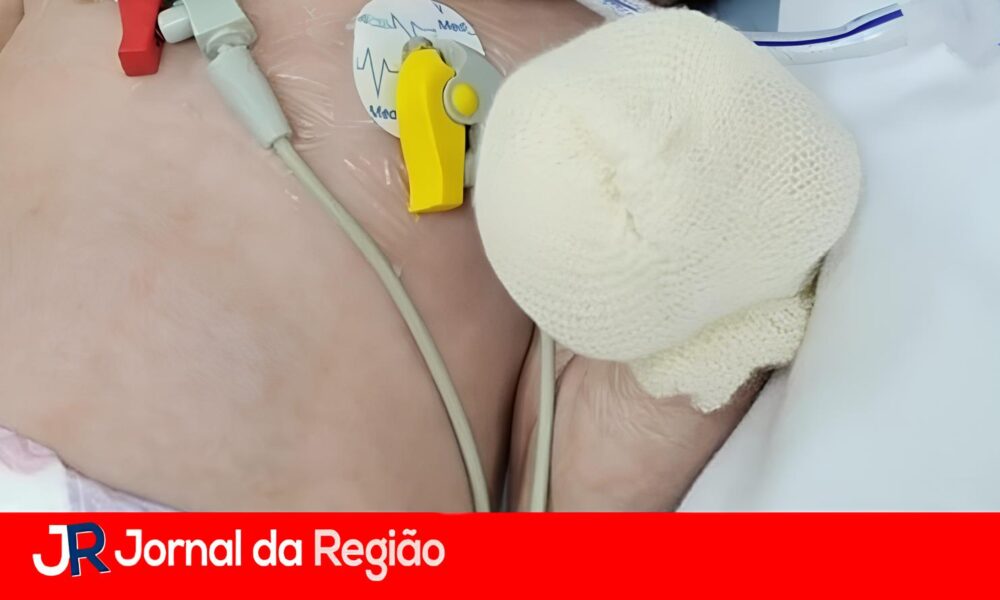 O Cora o de Isabella Uma M e na Luta Pela Vida de Sua Filha Contra a Burocracia do Sistema de Sa de