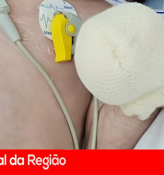 O Coração de Isabella: Uma Mãe na Luta Pela Vida de Sua Filha Contra a Burocracia do Sistema de Saúde 2 O Cora o de Isabella Uma M e na Luta Pela Vida de Sua Filha Contra a Burocracia do Sistema de Sa de