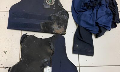 Quando o Dever Custa a Pele A Luta por Sobreviv ncia de um Guarda Municipal em Valinhos