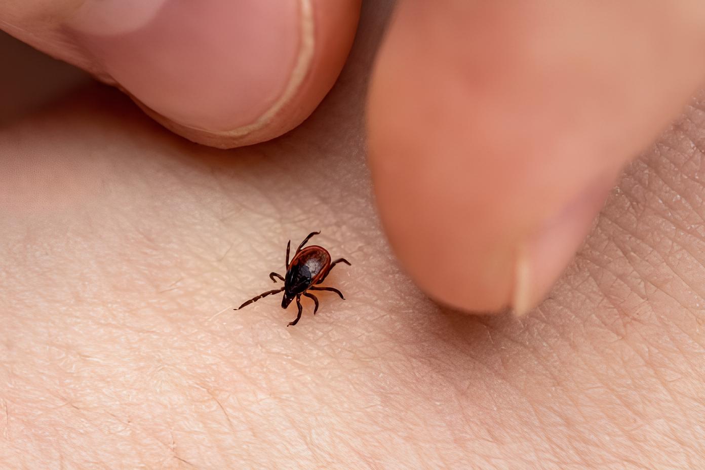 A Descoberta Surpreendente que Pode Mudar o Tratamento da Febre Maculosa Saliva de Carrapato Revela Poss vel Cura